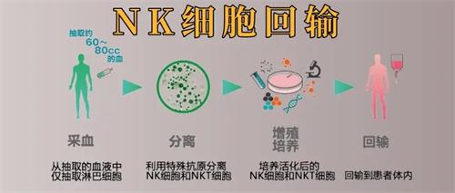 NK细胞疗法适用范围有哪些？癌症治疗、放化疗后的辅助治疗等