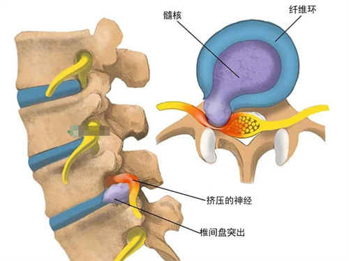 腰椎部位的图示