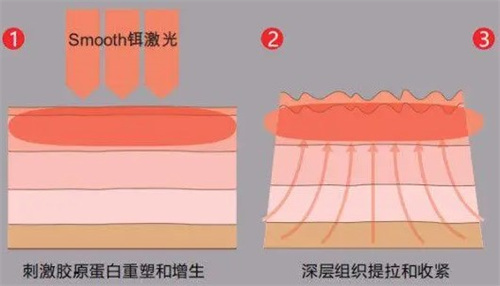 日本健康再生医院纤维芽细胞是什么？拥有胶原蛋白、弹性蛋白和透明质酸三大核心成分!