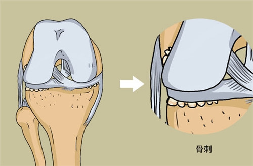 日本做干细胞再生治疗慢性疼痛原理分享，再生疗法修复明显体验好！