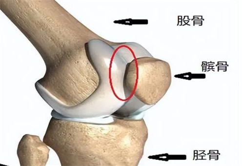 膝关节骨头剖析图