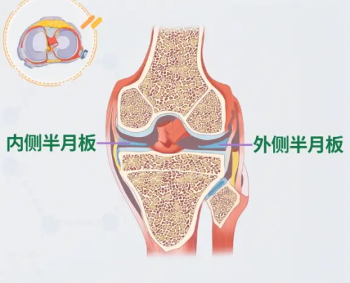 半月板动漫示意图