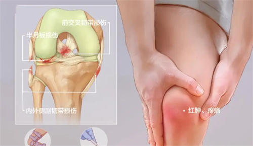 干细胞膝盖受损治疗方法