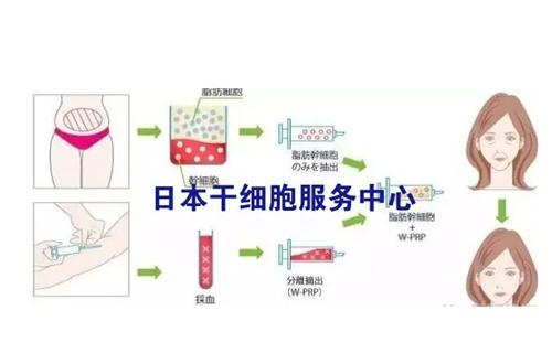 日本干细胞服务流程
