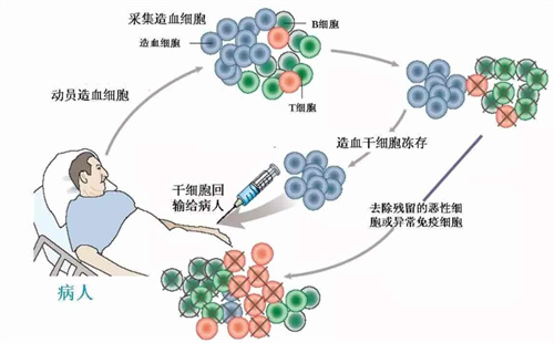 干细胞手术流程图