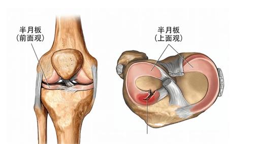 半月板的多方位展示图