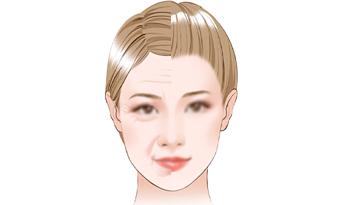日本大健康再生诊所面部抗衰老的意义