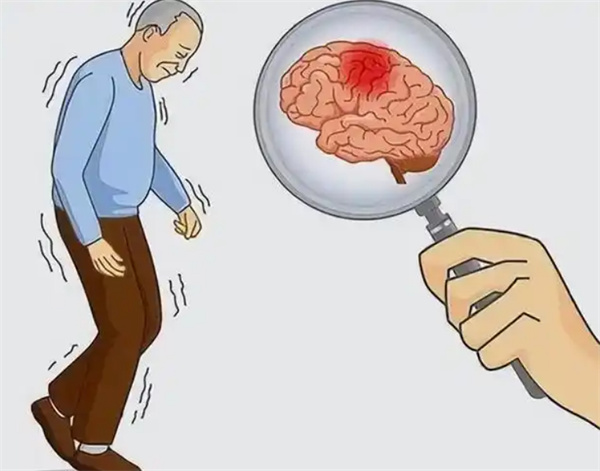 脑中风卡通图