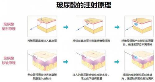 东京医美整形机构哪家好？BIANCA银座院/B-LINE美容/贝尔/LORE/圣心五家高人气医院介绍