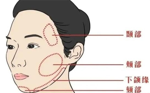日本B-LINE美容整形医院正规吗？做医美好不好？深度解析这家医院！