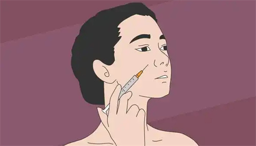 面部注射图