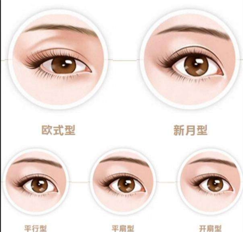 双眼皮类型图示 双眼皮类型图示