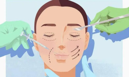 双眼皮手术操作示意图