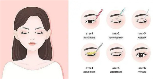 1760941584743784.jpg 1760941583686918.jpg