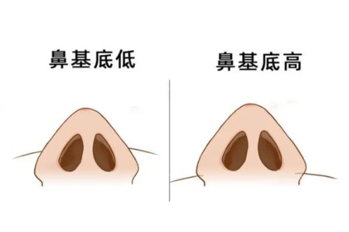 鼻基底展示图 鼻基底展示图