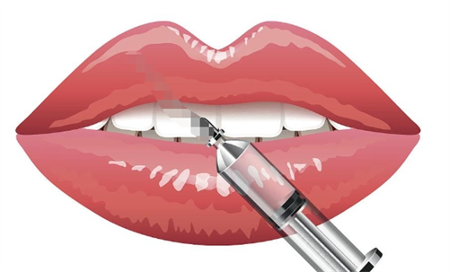 玻尿酸注射嘴巴动画展示 玻尿酸注射嘴巴动画展示