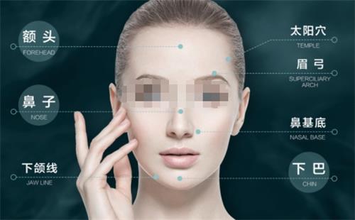 迪碧菲乐侧颜针可以注射的部位