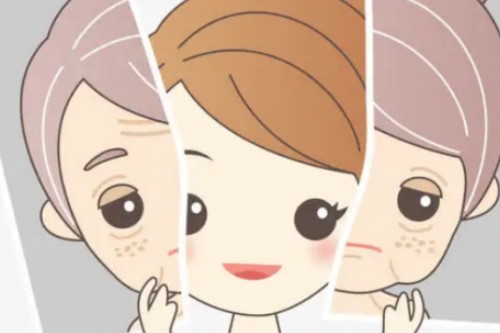 面部提升卡通展示图 面部提升卡通展示图