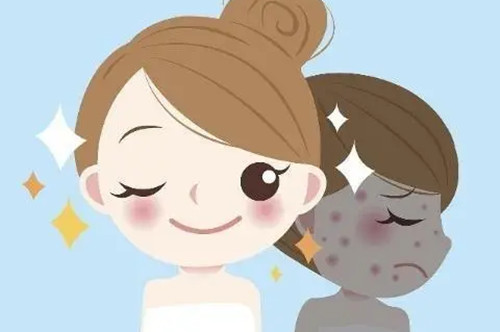 光子嫩肤前后对比卡通示意图