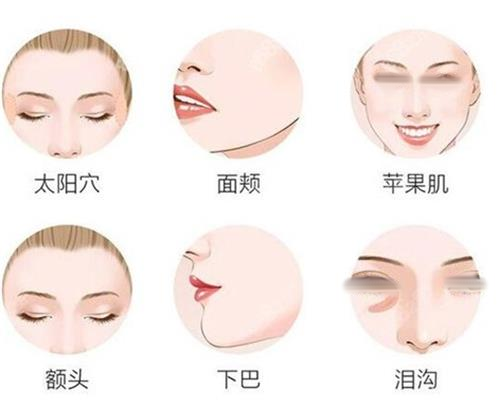 面部填充部位一览图 面部填充部位一览图