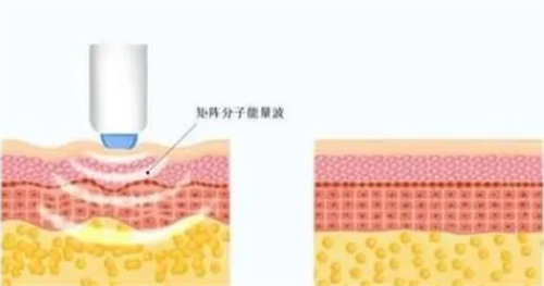 圣心美容医院银座院怎么样？面部抗衰/身体塑形等做得好！