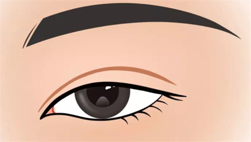 双眼皮形态展示