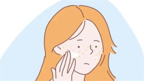 激光祛斑前 激光祛斑前