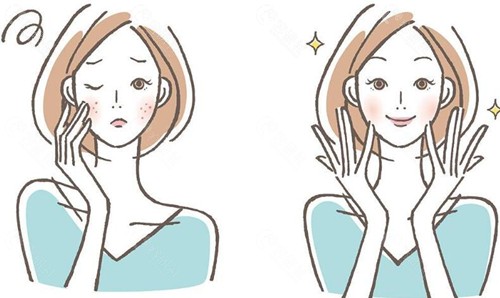 激光祛斑后的成效 激光祛斑后的成效